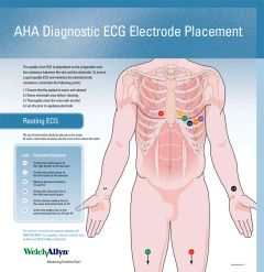 AHA Diagnostic ECG Electrode Placement